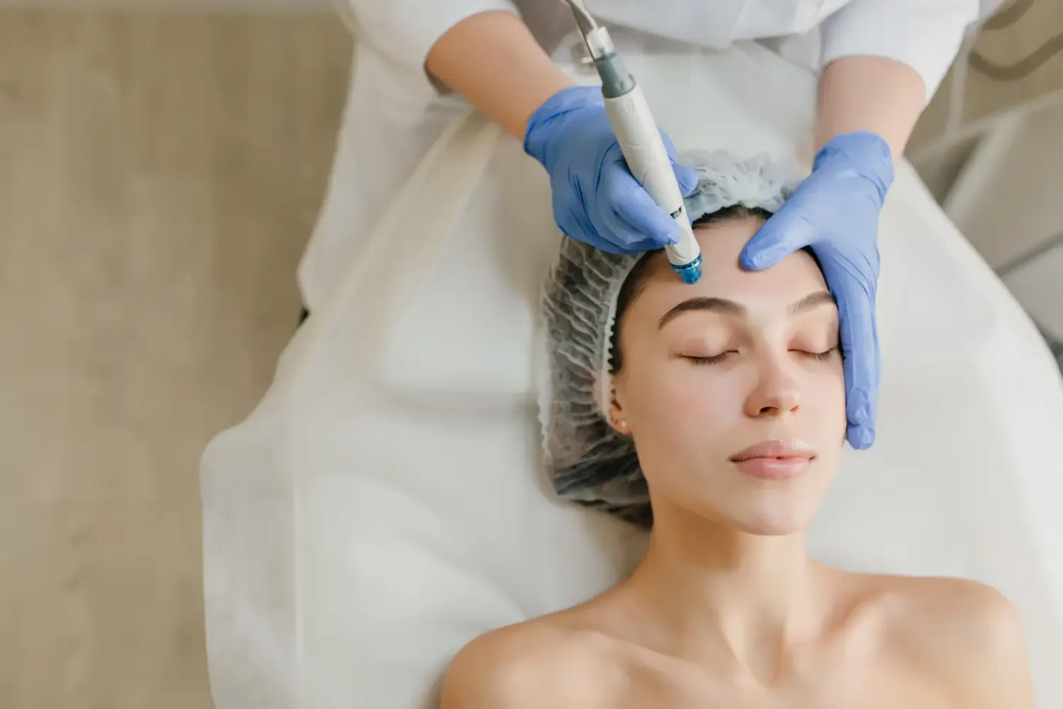 Microneedling+ Nanoneedling: Vorteile