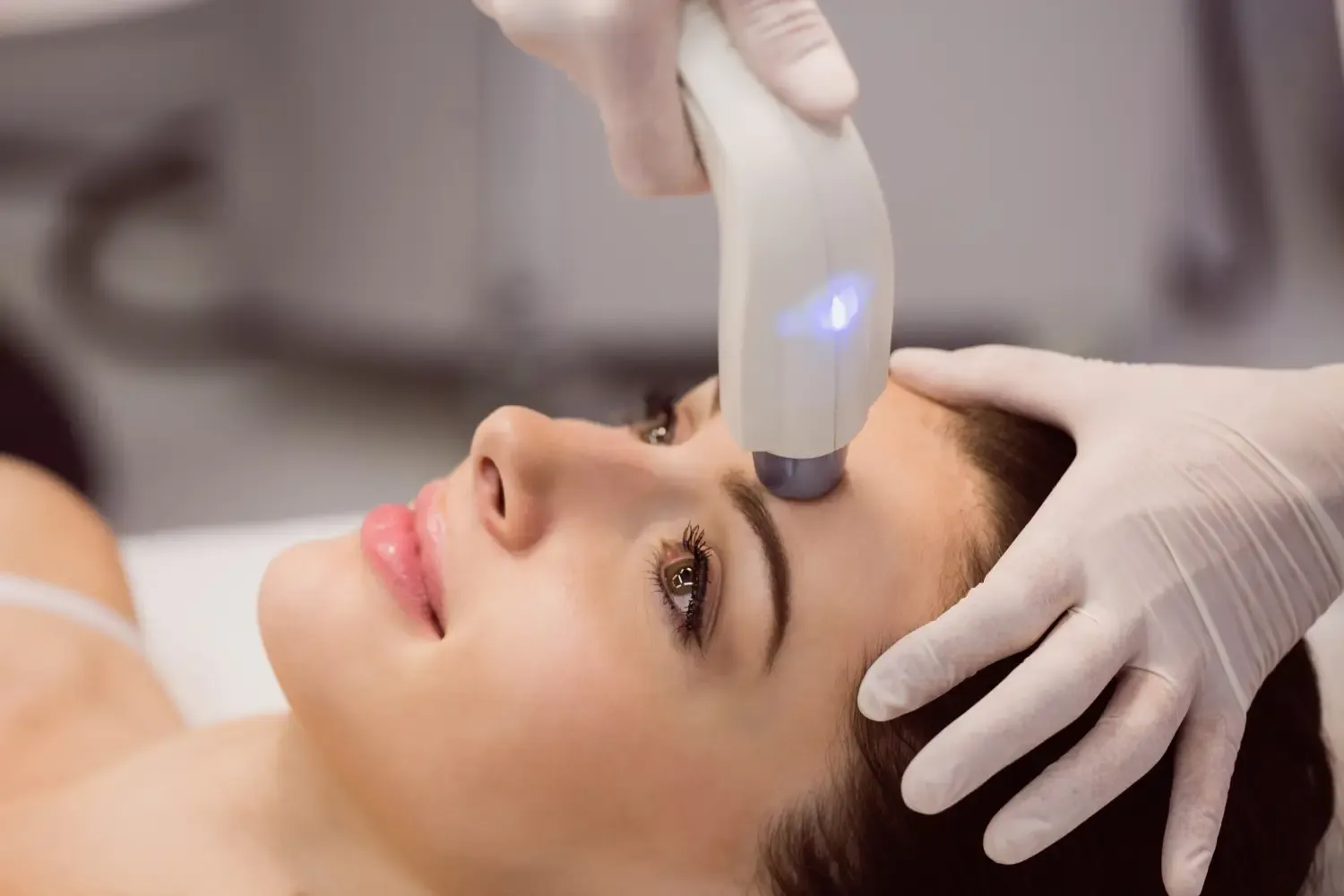 Fraxel Laser: Anwendungsgebiete