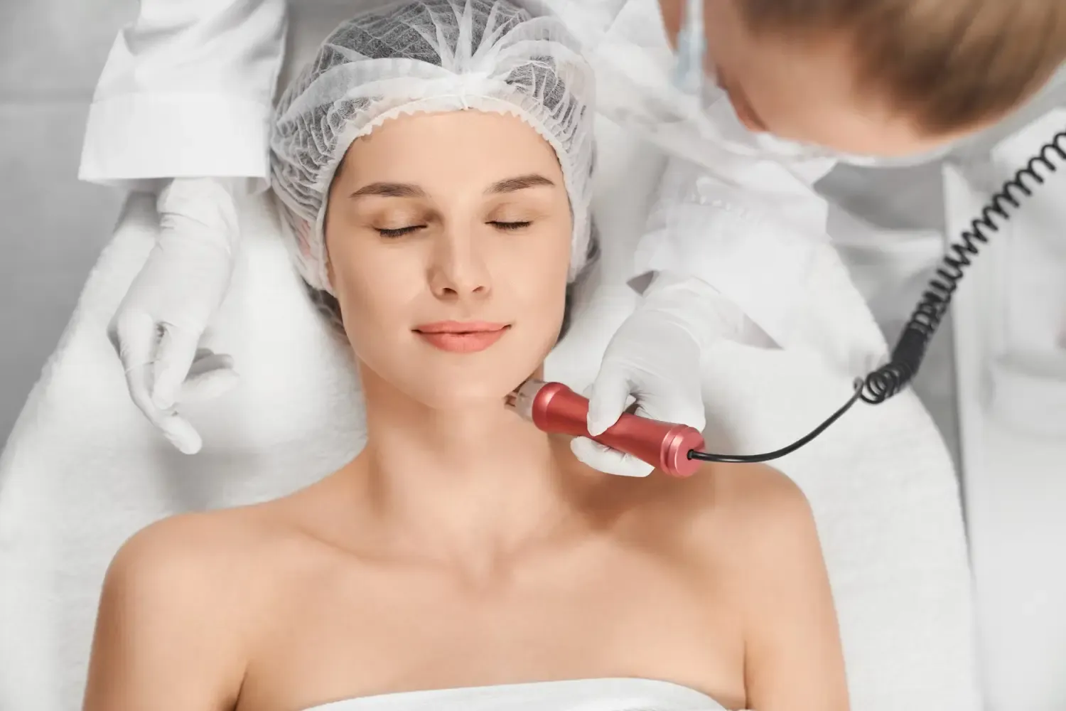 Fraktionierte RF Microneedling: Anwendungsgebiete