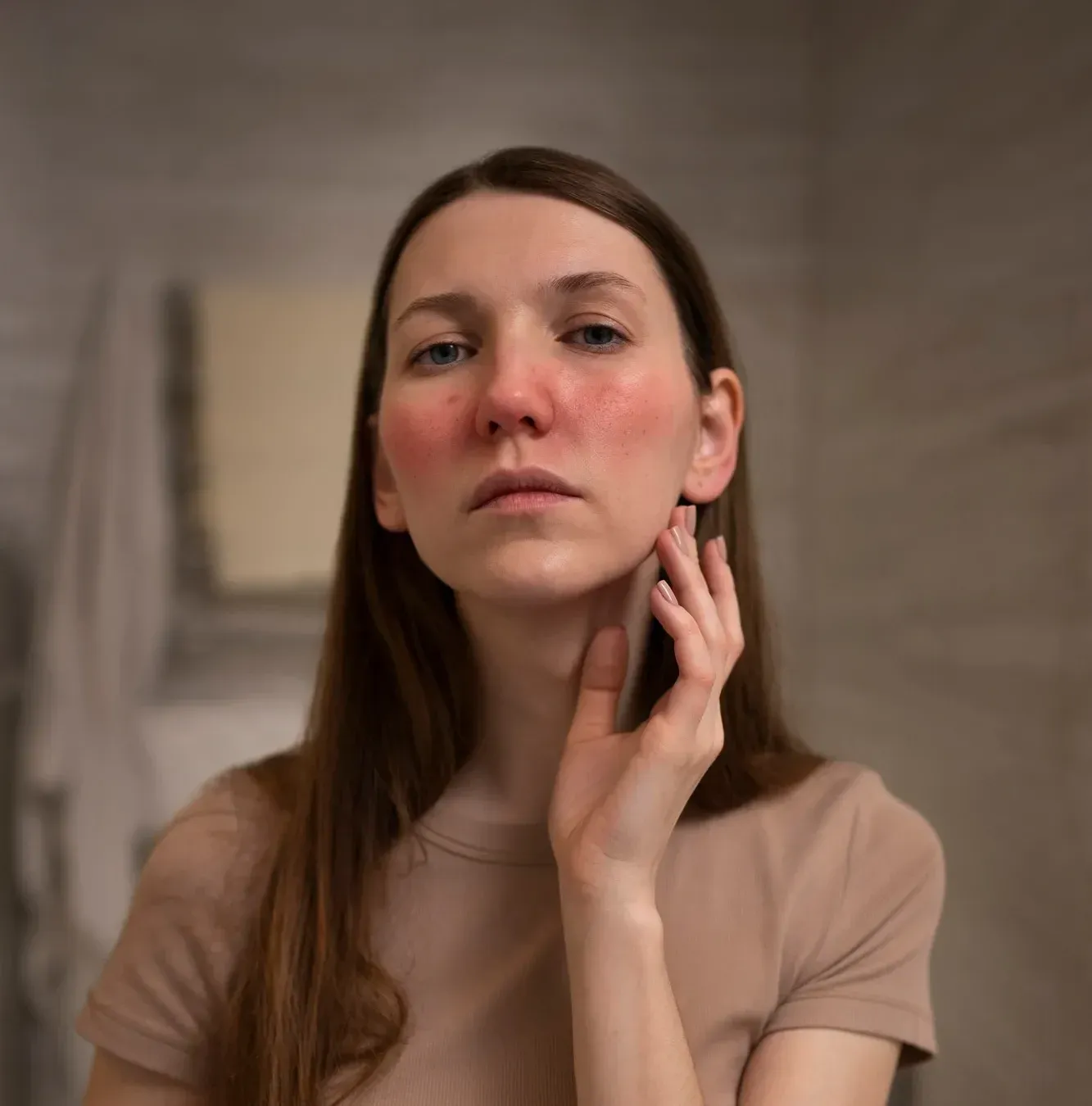 Couperose / Rosacea