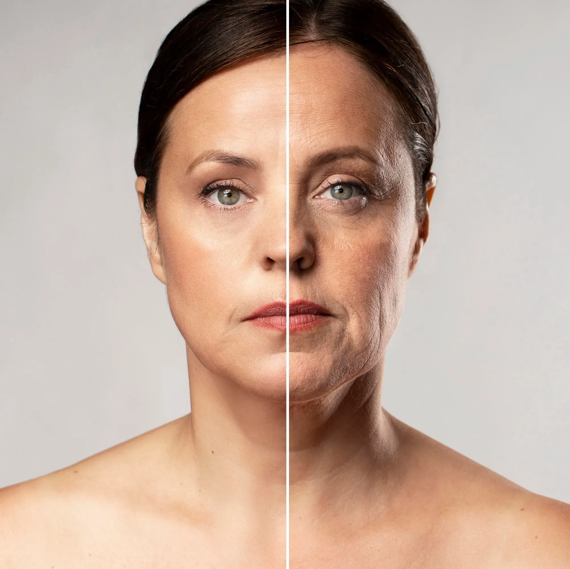 Cellulitebehandlung mit V-Shape: Technologie