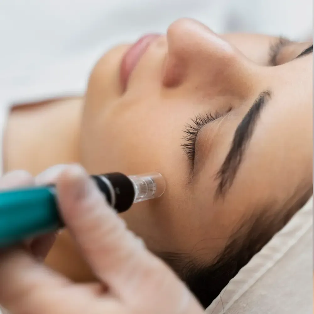 Skin Booster – Lifting: Was ist Mesotheraphie oder Mesolifting?